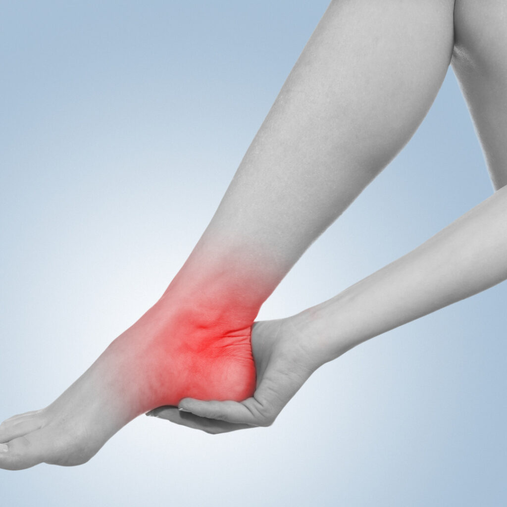 Entorse de Tornozelo