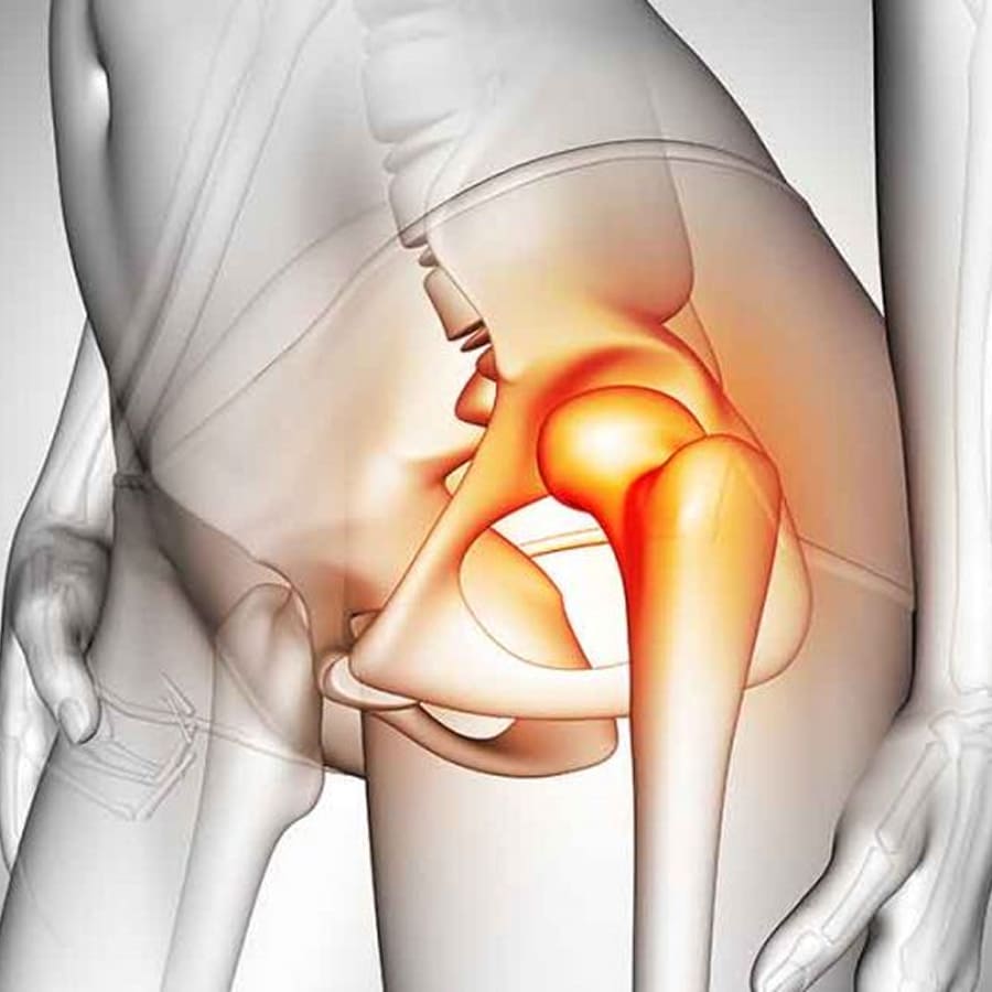 Lesão Labral