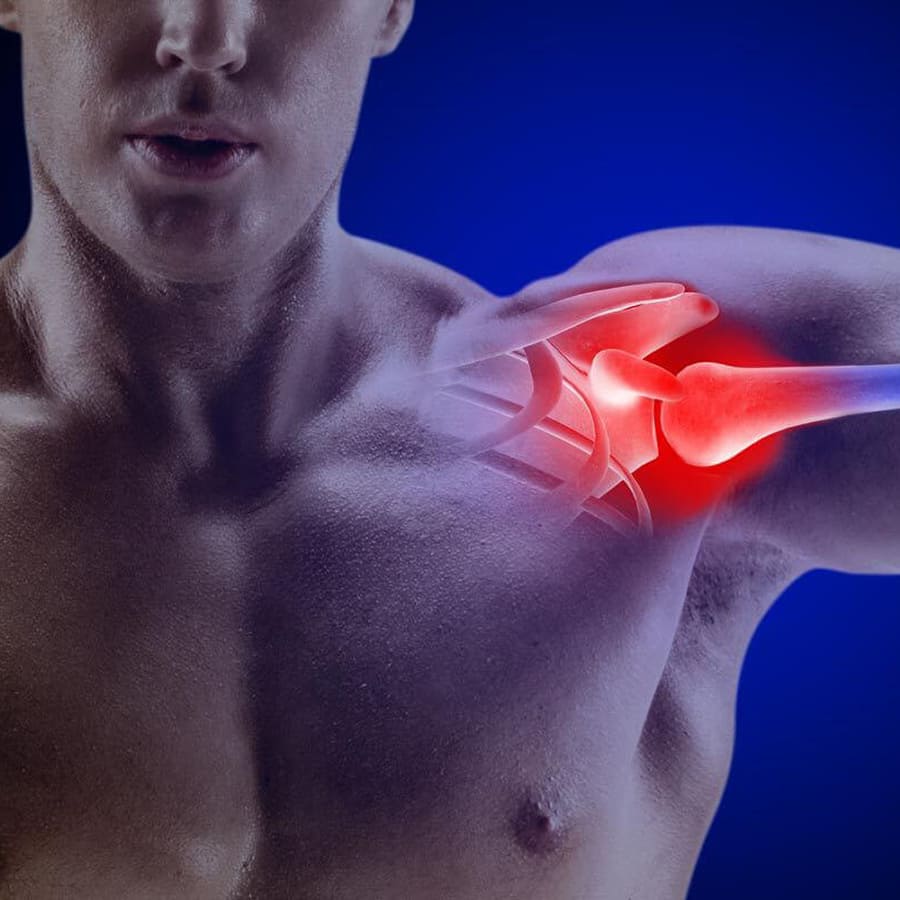 Luxação no Ombro